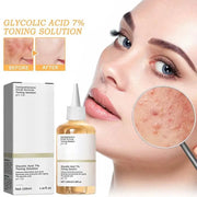 Toner Remove Acne Fade Glycolic Acid 7% Marks Improve Skin Whitening Moisturiz