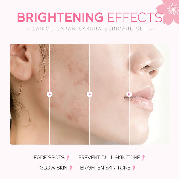 Sakura Skincare Oil Control Facial Cleaner Face Serum Face Cream Fade Dark Circles Eye Cream Face Care Products