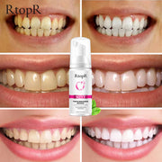RtopR Teeth Cleansing Whitening Mousse