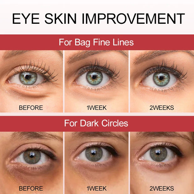 Peptide Eyes Cream Dark Circles Remover