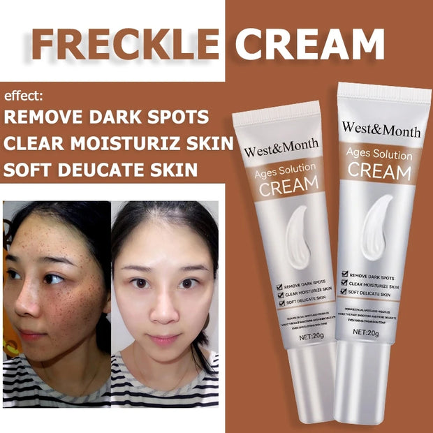 Remove Freckle Cream Whitening Dark